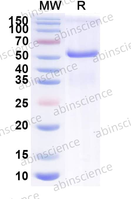 Mouse EFNA5 Recombinant Protein (C-Fc)