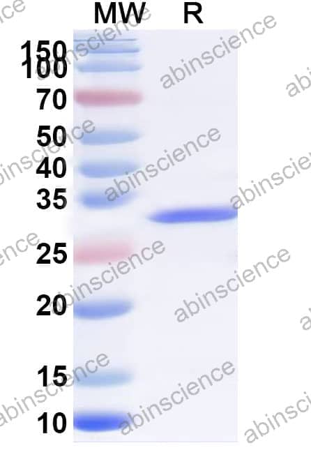Mouse PPT1 Recombinant Protein (N-His)