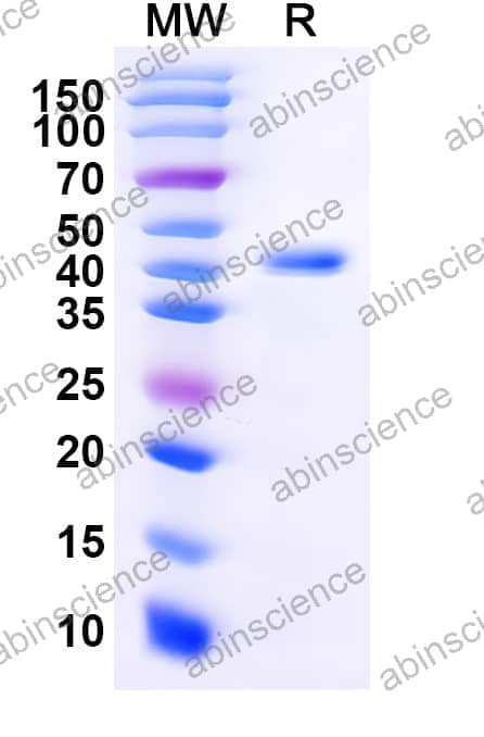 Mouse ACVR1B Recombinant Protein (C-Fc)