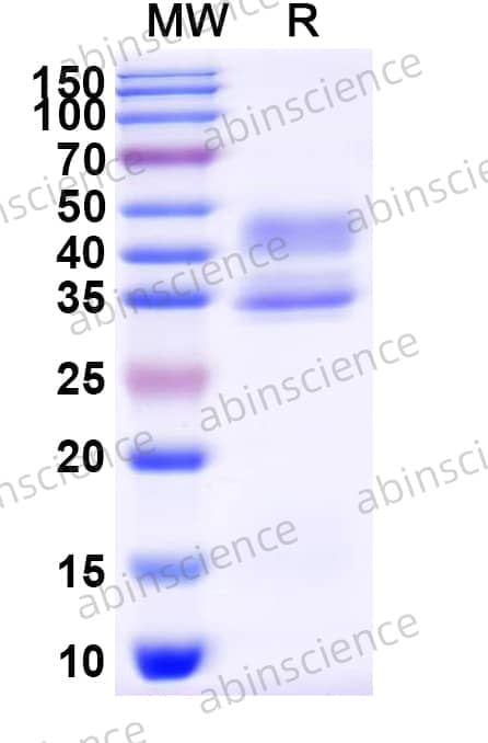 Mouse ACVR1B Recombinant Protein (C-Fc)