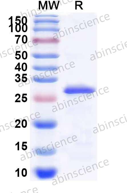 Mouse GZMK Recombinant Protein (N-His)