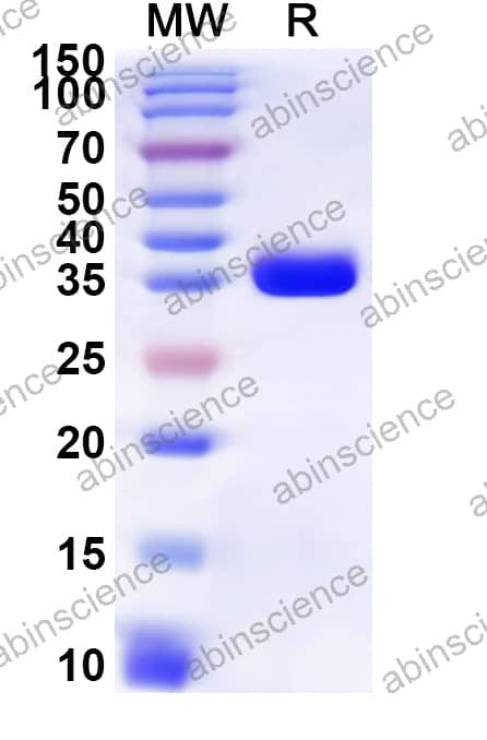 Mouse NUP62 Recombinant Protein (N-GST & C-His)