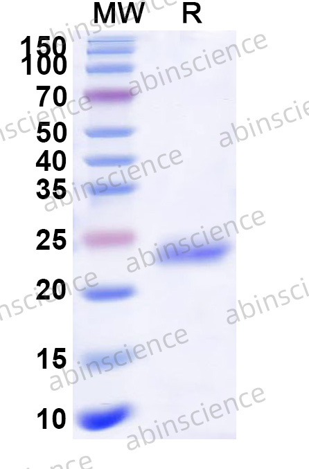 Mouse TIMP3 Recombinant Protein (N-His)