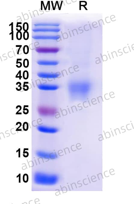 Mouse EFNA3 Recombinant Protein (C-His)