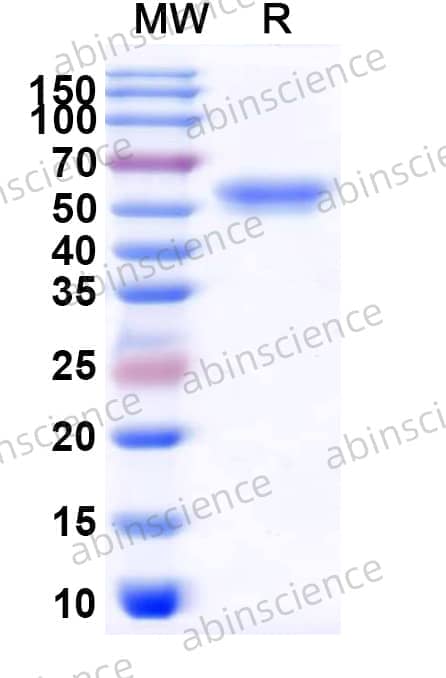 Mouse CD292/BMPR1A Recombinant Protein (C-Fc)