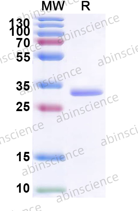 Mouse VDAC2 Recombinant Protein (N-His)