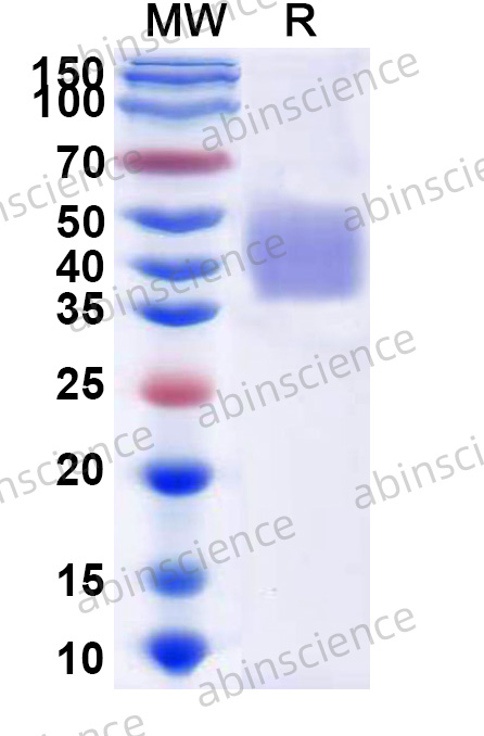 Mouse B7-1/CD80 Recombinant Protein (C-His)