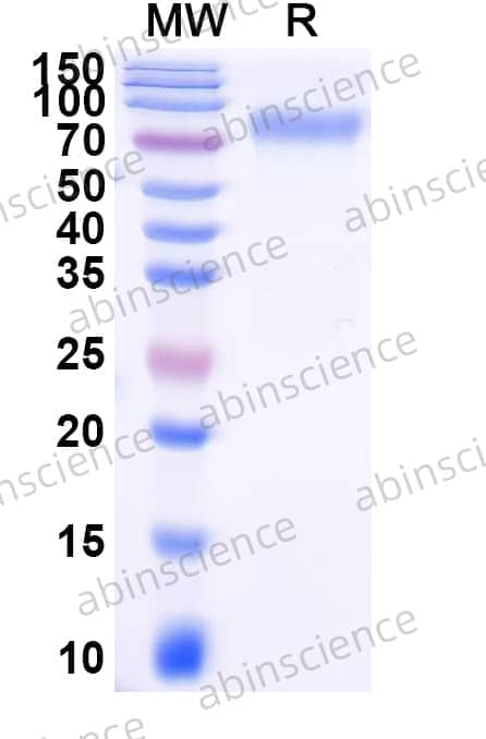 Mouse CD80 Recombinant Protein (C-Fc)