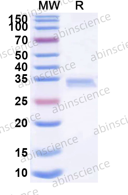 Mouse HSPA4 Recombinant Protein (N-His)