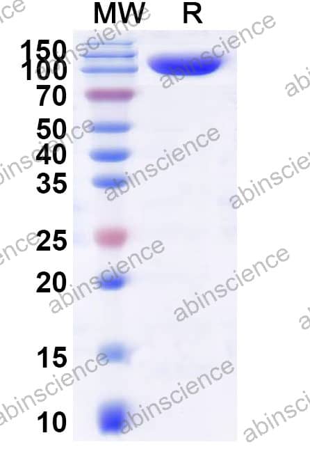 Mouse STAT3 Recombinant Protein (N-GST)