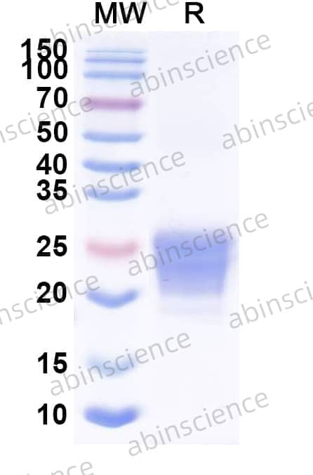Recombinant Mouse CD70 Protein, C-His