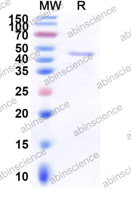 Mouse HMGA2 Recombinant Protein (N-His)