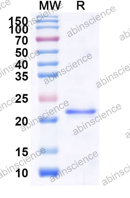 Mouse CXADR Recombinant Protein (C-His)