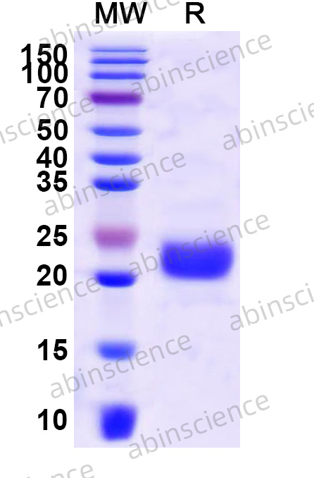 Mouse GFRA1 Recombinant Protein (N-His)