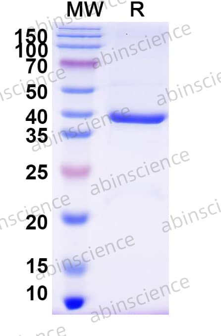 Mouse Uba52 Recombinant Protein (N-GST)