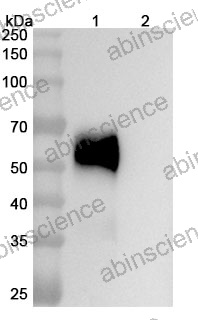 Anti-Human ST2/IL-33R Reference Antibody (Astegolimab, RUO)