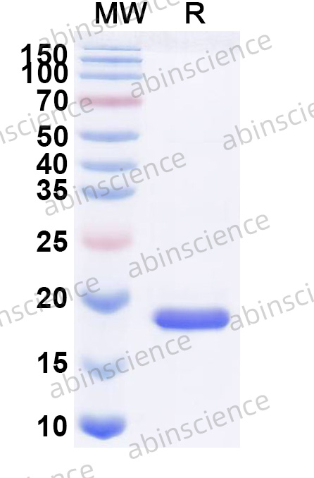Mouse AIF1 Recombinant Protein (N-His)