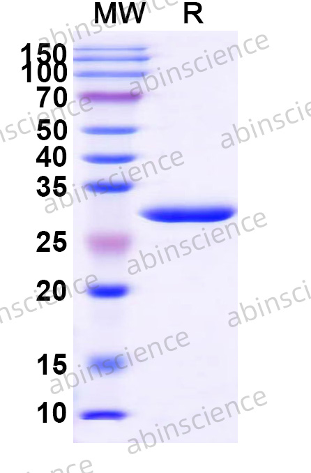 Mouse YWHAZ Recombinant Protein (N-His)