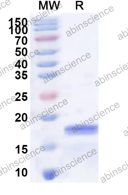 Mouse CRISP3 Recombinant Protein (N-His)