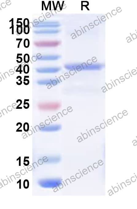 Mouse MUC2 Recombinant Protein (N-His)