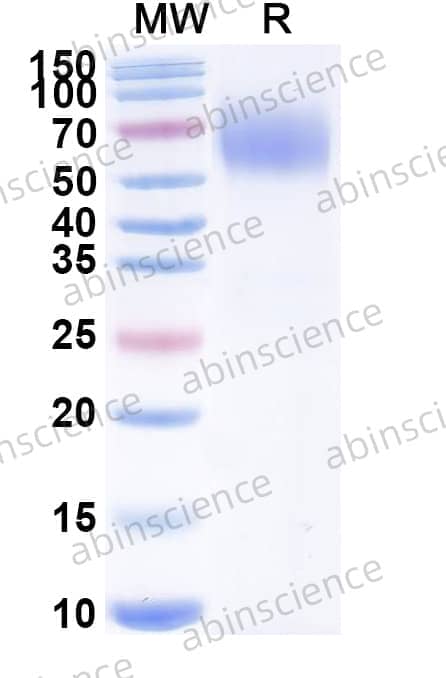 Mouse CD172a/SIRPA Recombinant Protein (C-His)