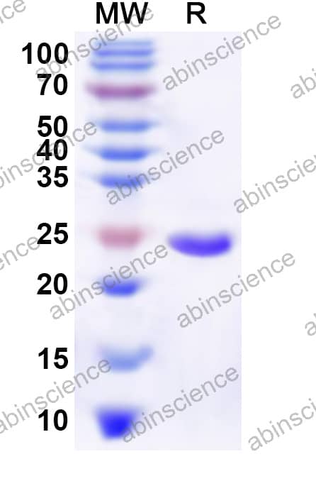 Mouse TMSB4X Recombinant Protein (N-His-KSI)