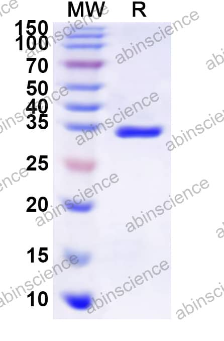 Mouse SLURP1 Recombinant Protein (N-GST & C-His)
