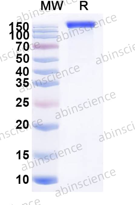 Recombinant Mouse CD115/CSF1R Protein, C-Fc