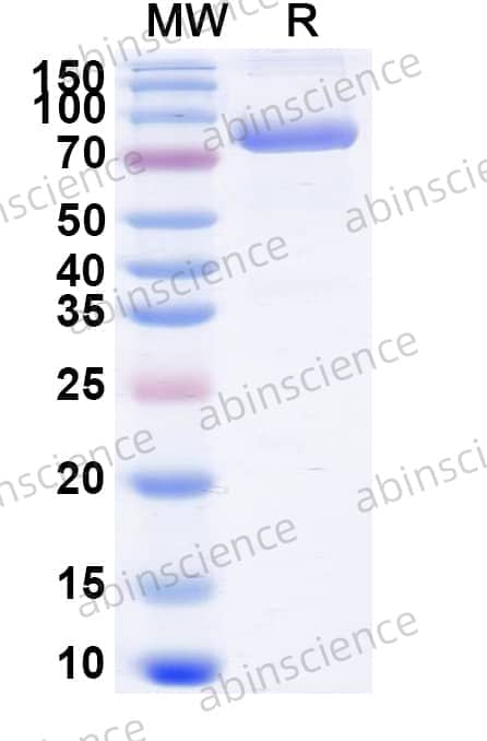 Mouse Transferrin R/TfR Recombinant Protein (C-His)