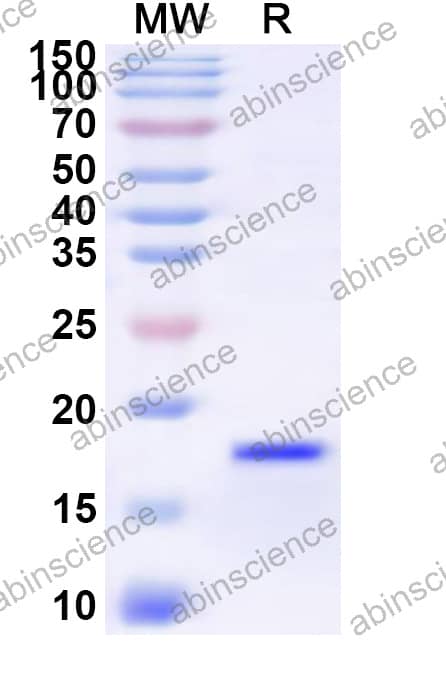 Mouse ANG Recombinant Protein (N-His)