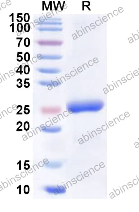 Mouse IFI30 Recombinant Protein (N-His)
