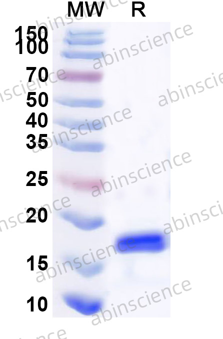 Mouse IRF1 Recombinant Protein (N-His)