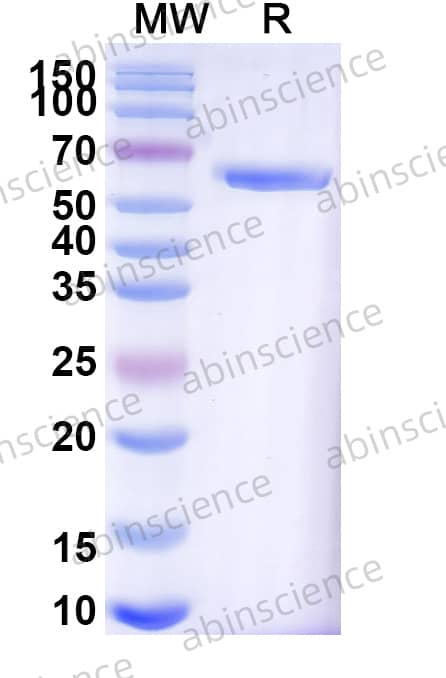 Mouse HSPD1 Recombinant Protein (N-His)