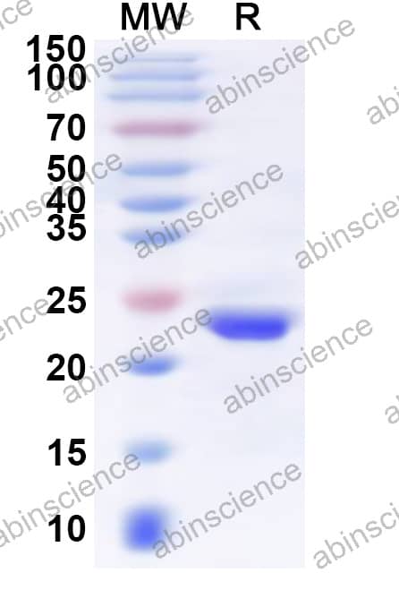 Mouse SOD3 Recombinant Protein (N-His)