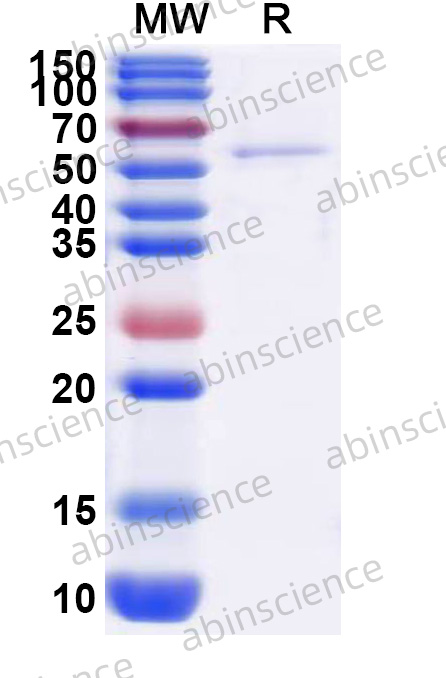 Mouse Osteopontin/OPN Recombinant Protein (C-His)