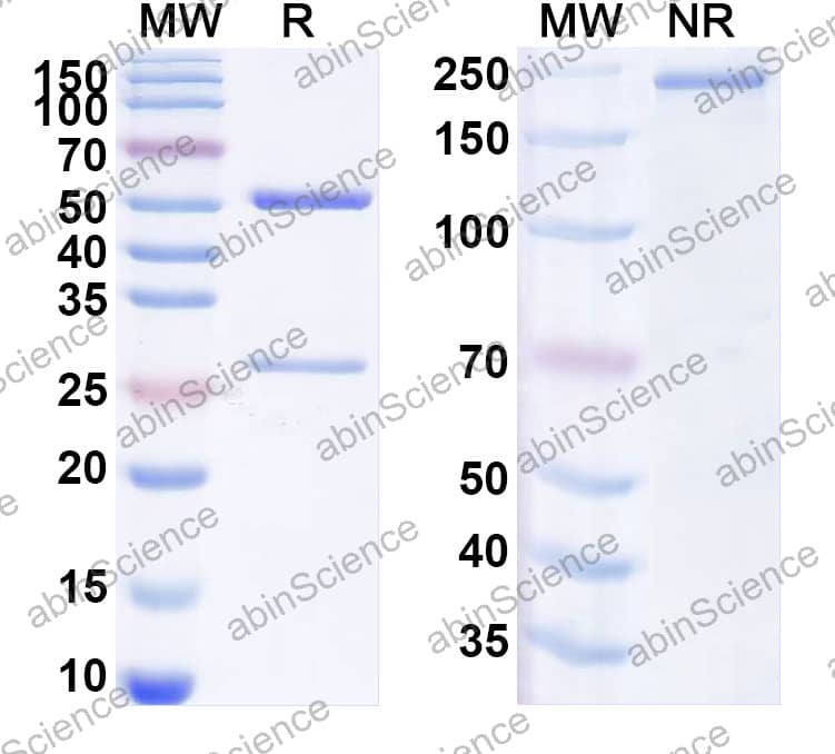 Anti-Mouse OPN/Spp1 Recombinant Antibody (SAA2558)
