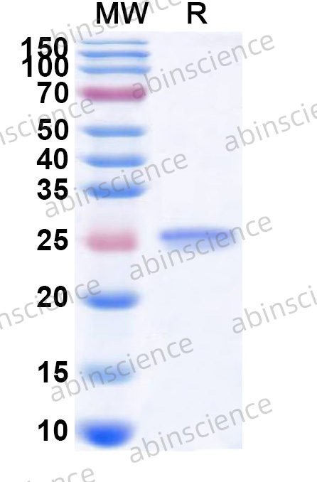 Recombinant Mouse CTSG Protein, N-His
