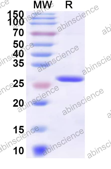 Mouse ADRB2 Recombinant Protein (N-His-KSI)