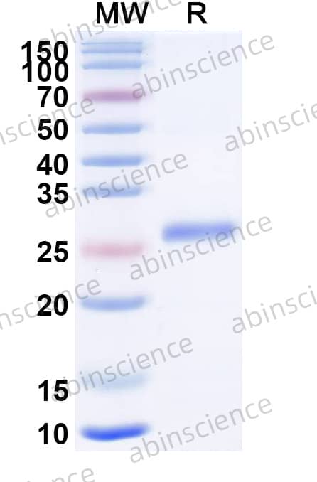 Mouse PRSS1 Recombinant Protein (N-His)