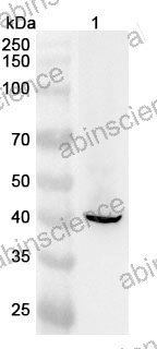 Anti-KRT19 Polyclonal Antibody