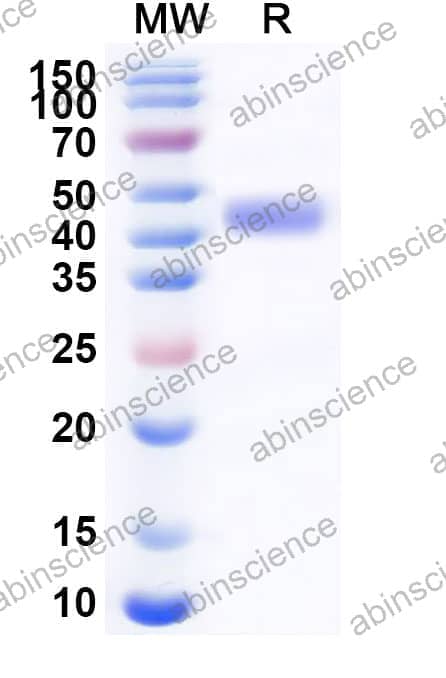Recombinant Mouse TFPI Protein, C-His
