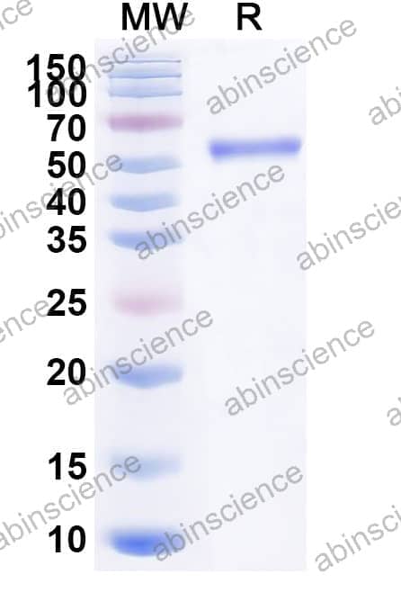 Recombinant Mouse TFPI Protein, C-Fc