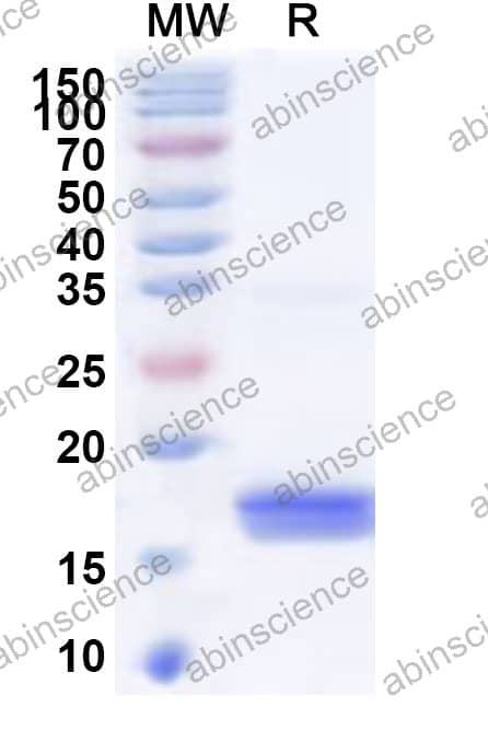 Mouse VCAN Recombinant Protein (N-His)