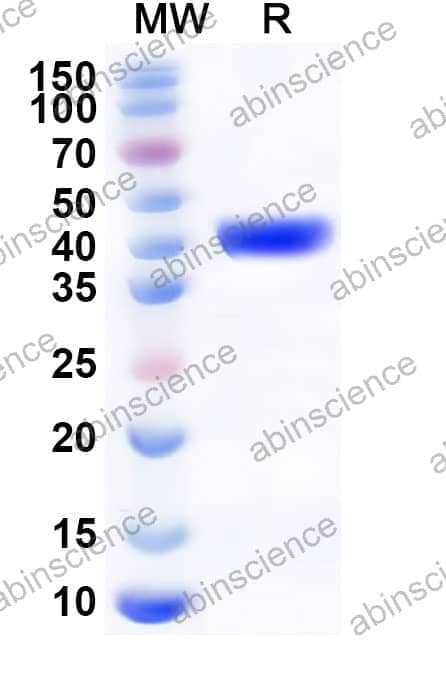 Mouse PLA2G1B Recombinant Protein (C-Fc)