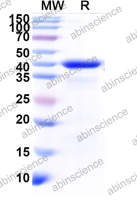 Mouse PDHA1 Recombinant Protein (N-His)