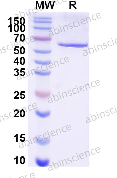 Malus domestica/Apple Catechol oxidase/PPO Recombinant Protein (C-His)