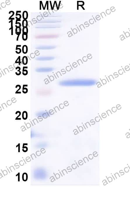 Nicotiana tabacum Endochitinase A/CHN48 Recombinant Protein (N-His)