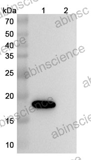Anti-Bet v 1 Allergen Reference Antibody (Atisnolerbart, RUO)