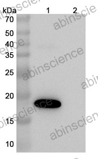 Anti-Bet v 1 Allergen Reference Antibody (Bremzalerbart, RUO)