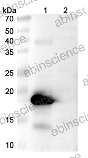 Anti-Bet v 1/Allergen Bet v I-A Recombinant Antibody (SAA0666)